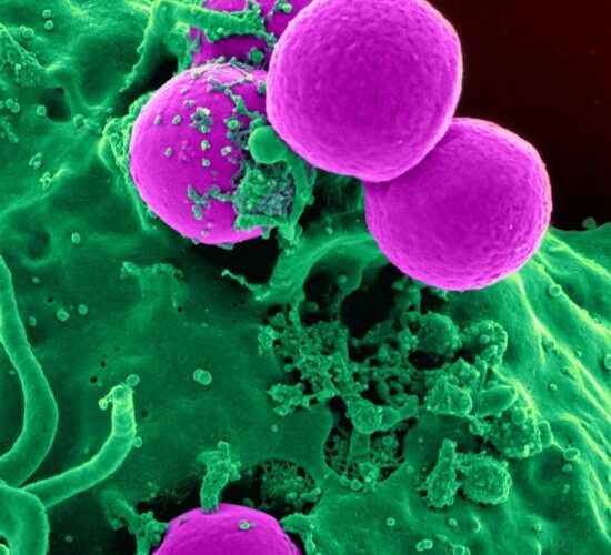 pexels-pixabay-45239 pexels-pixabay-45239